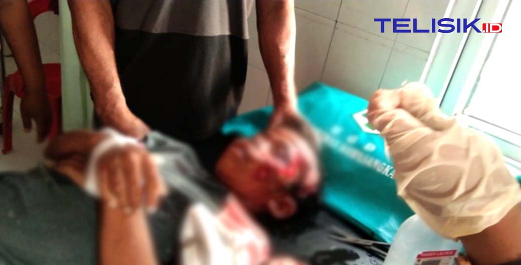 Pick Up Hilangkan Nyawa Seorang Bocah di Buteng