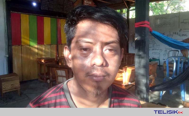 Korban Pemukulan Tolak Permohonan Maaf Ajudan Bupati Butur