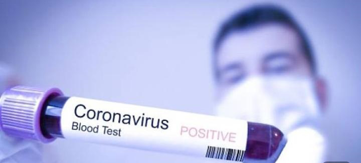 WNA di Kendari Jadi Perhatian Penyebaran Virus Corona