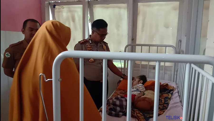 Bocah Pengidap Gizi Buruk di Bombana Butuh Uluran Tangan 