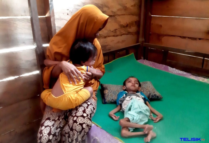 Lima Tahun Menderita Gizi Buruk, Balita Ini Hanya Bisa Terbaring Kaku