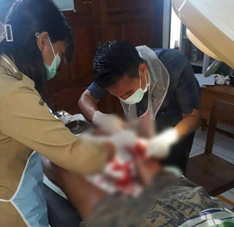 Seorang Pria di Bombana Berlumuran Darah Selamat dari Terkaman Buaya 