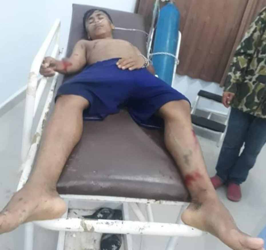 Seorang Pemuda di Konsel Nyaris Tewas Diterkam Buaya