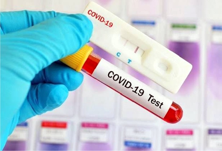 Eks Penumpang KM Lambelu akan Dites Rapid