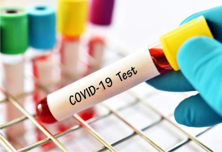 ODP di Konawe Bertambah Satu Kasus Baru