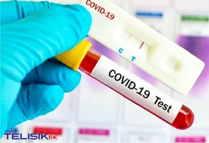 Perawat RSUD Bahteramas Positif Corona