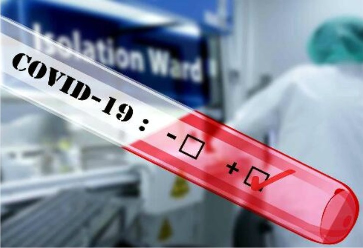 109 OTG Buton Tengah Dirapid Test