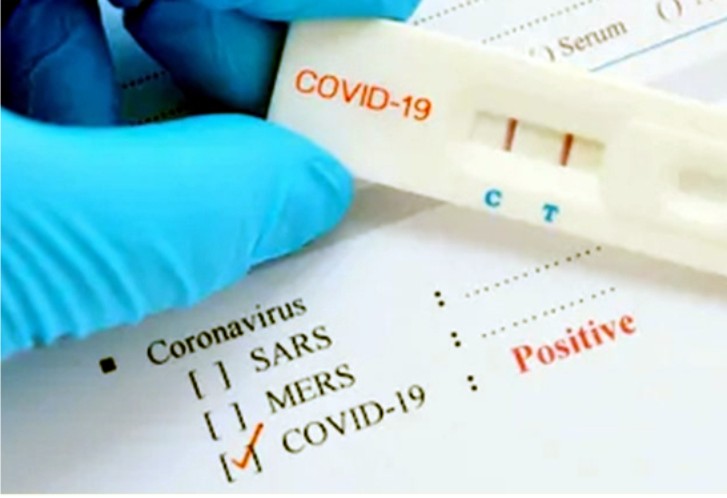 Begini Awal Mula Ditemukannya Pasien COVID-19 di Kolaka Utara