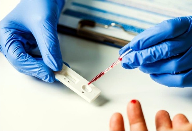 Dokter Reisa: Tak Perlu Takut, Rapid Test tidak Sama dengan Karantina