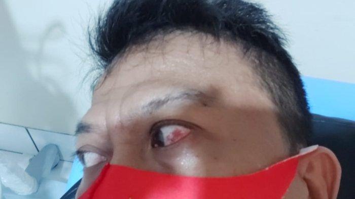 Kader PDIP Dikeroyok dan Dipukuli Oknum Satgas PDIP