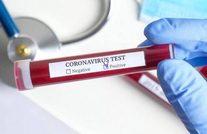 Tiga Hari Berturut-turut, Pasien Positif COVID-19 di Kendari Terus Melejit