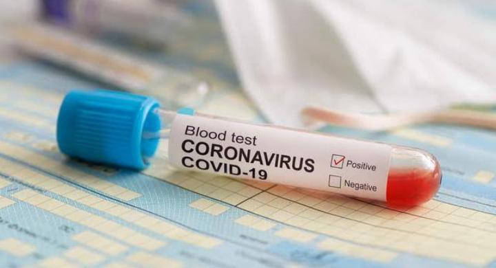 20 Orang di Kendari Kembali Terinfeksi COVID-19