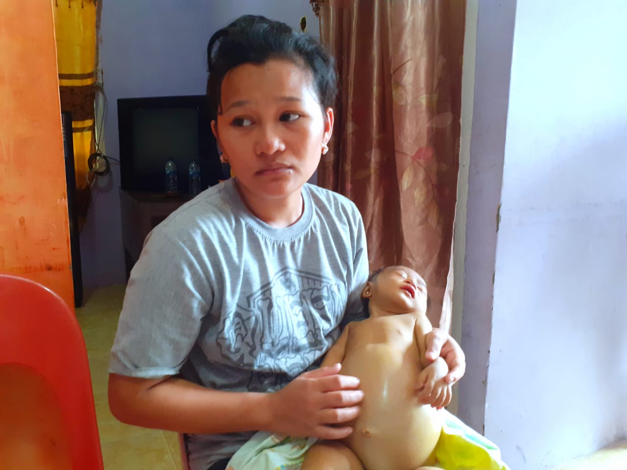 Bayi yang Lahir Tanpa Empedu Ini Butuh Uluran Tangan