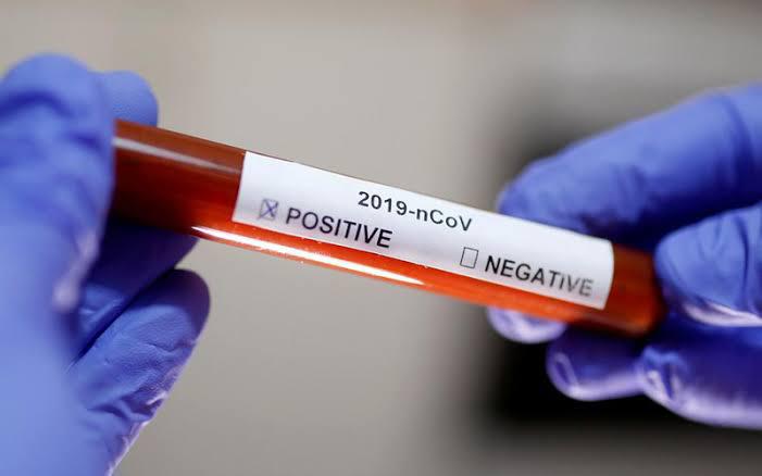 Positif COVID-19 di Sultra Bertambah Lagi 49 Kasus, Meninggal Satu Orang