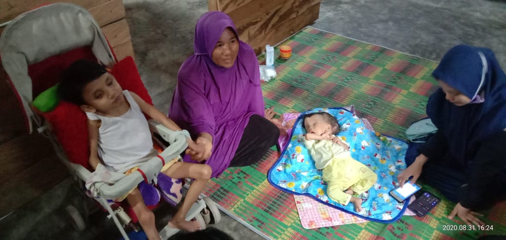 Dua Anak Penderita Gizi Buruk di Konsel Butuh Uluran Tangan
