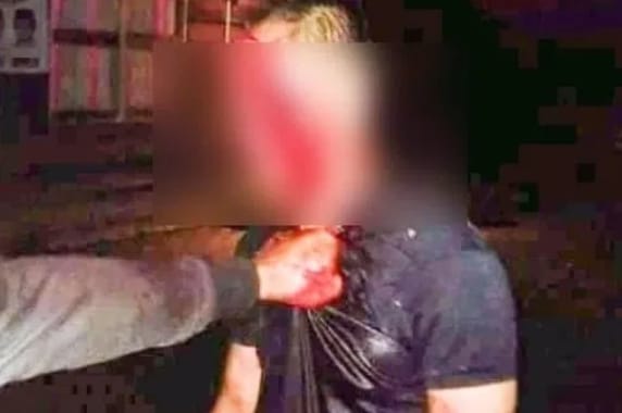 Kepergok Selingkuh, Suami Sah Tebas Leher Si Pria di Konsel