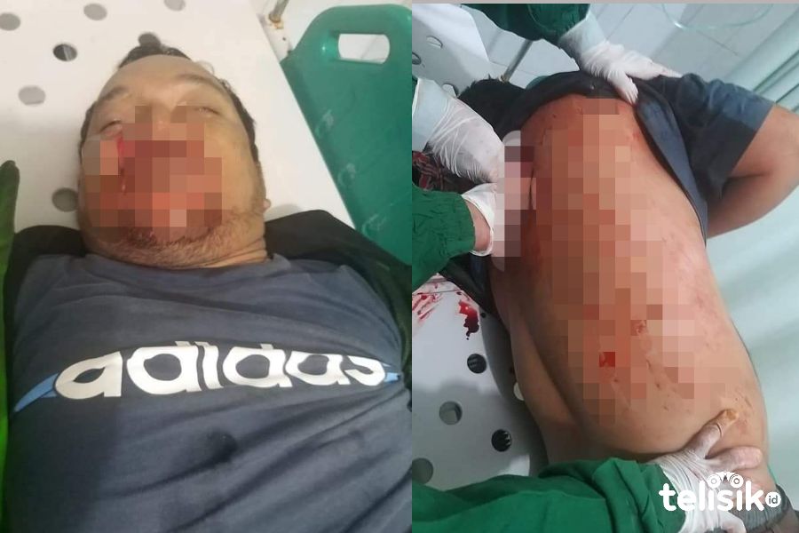 Driver Ojol Tewas Ditikam Penumpangnya