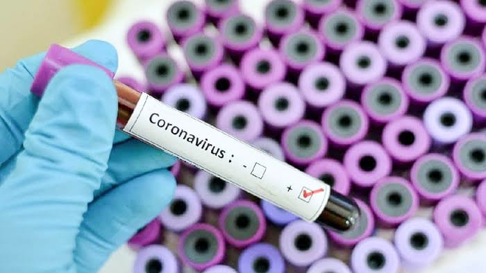 Hari Ini, Pasien Sembuh Bertambah 100 Orang dan Positif 90 Kasus