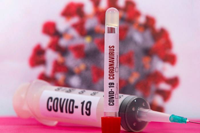 Hari Ini, Sembuh COVID-19 Bertambah 71 Orang dan Dua Meninggal Dunia