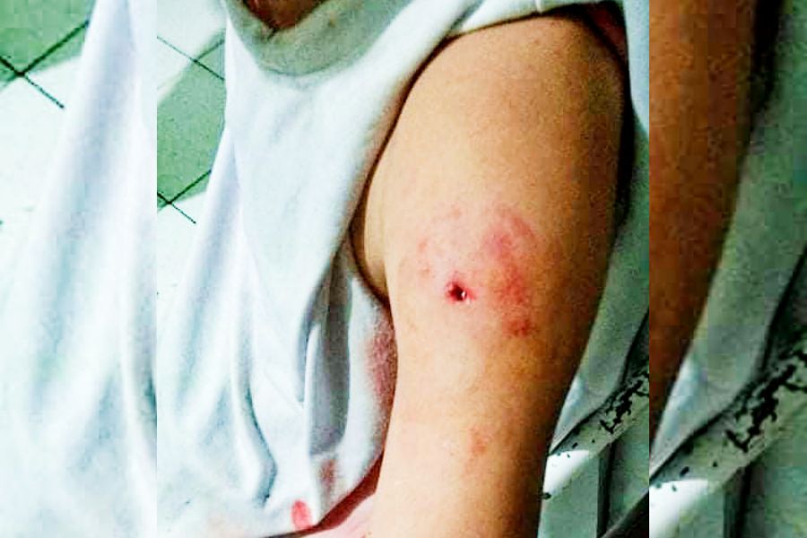 LBH Kepton Minta Polres Tindak Lanjuti Laporan Penembakan Mahasiswa