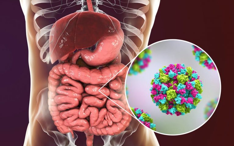 Masyarakat Diimbau Waspadai Norovirus Penyebab Keracunan Makanan