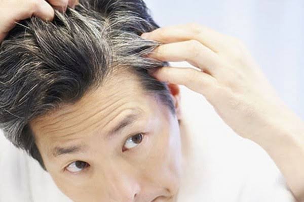 7 Penyebab Uban Muncul Meski Masih Muda