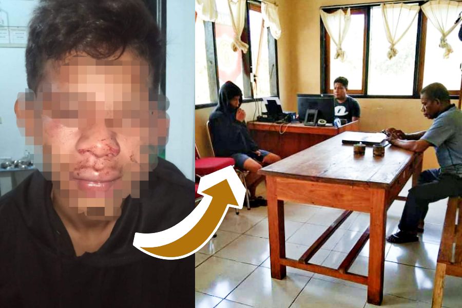 Ketua DPRD Busel Diduga Aniaya Anak di Bawah Umur