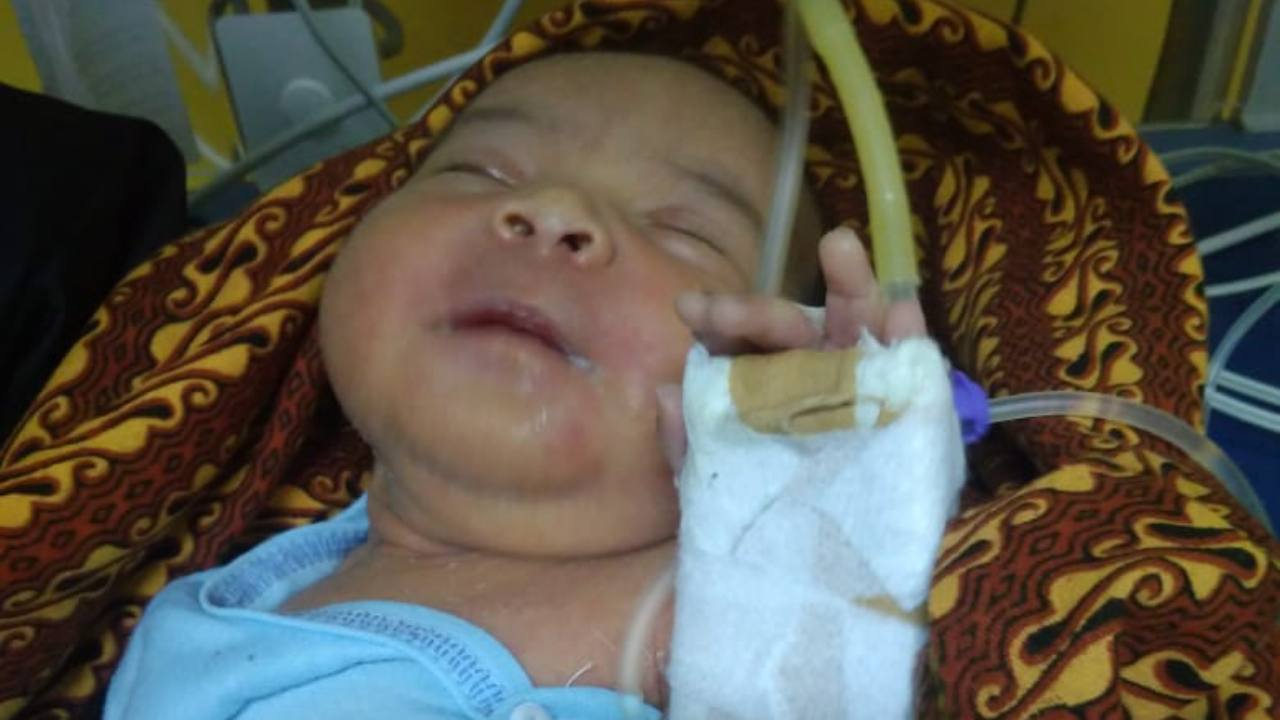 Bayi Tanpa Anus Dilarikan ke RS Bahteramas, Keluarga Butuh Bantuan Dermawan
