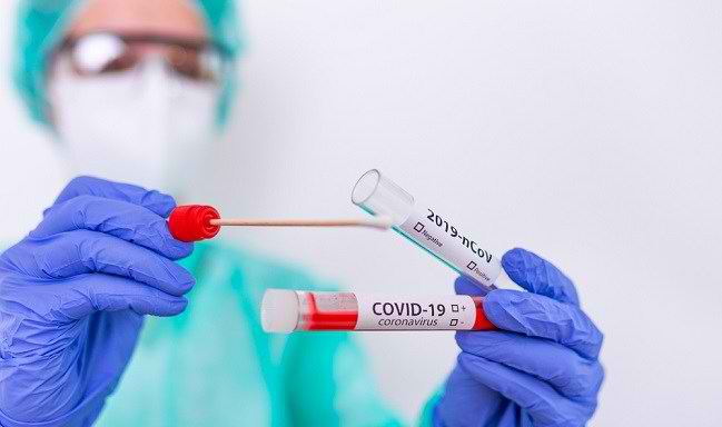 Hari Ini, 55 Pasien COVID-19 di Sultra Dinyatakan Sembuh