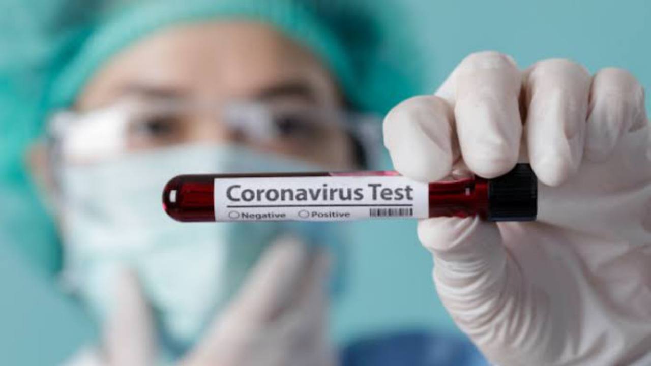 Hari Ini, 55 Warga Sultra Positif COVID-19