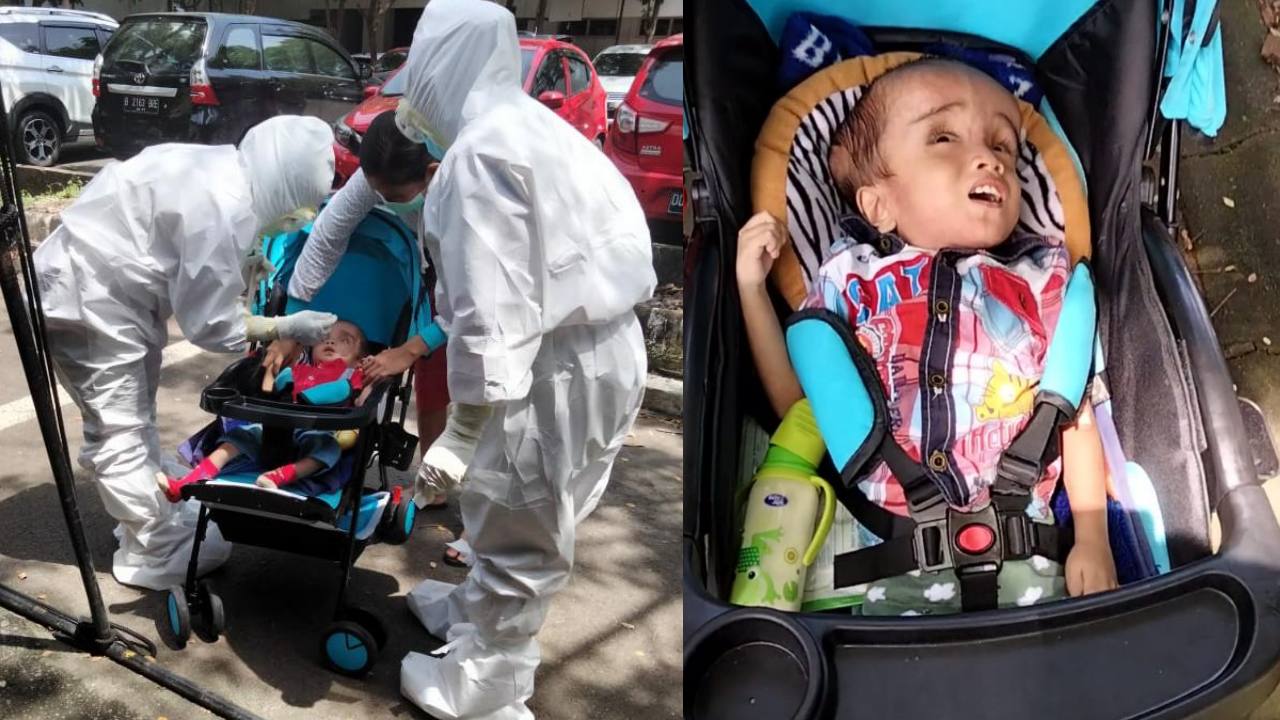 Masih Ingat Balita Penderita Gizi Buruk dan Hidrosefalus di Buton? Begini Kondisinya