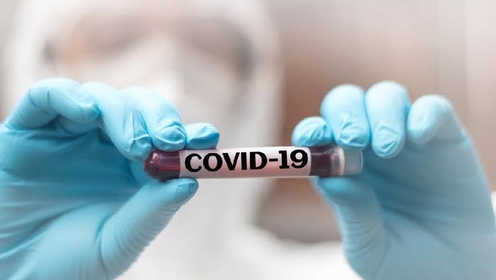 Hari Ini, Pasien COVID-19 di Sultra Bertambah Dua Orang