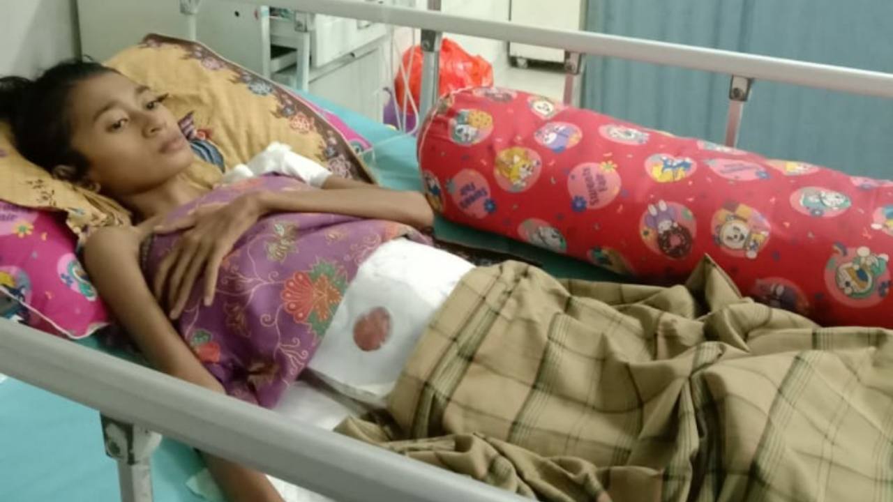 Remaja Penderita Kista dan Usus Bocor di Wakatobi Butuh Uluran Tangan