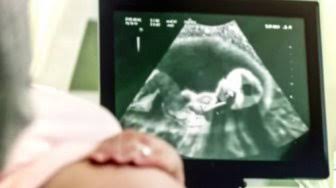 Heboh Wanita Hamil Tanpa Berhubungan Seks di Cianjur, Mungkinkah Secara Sains?