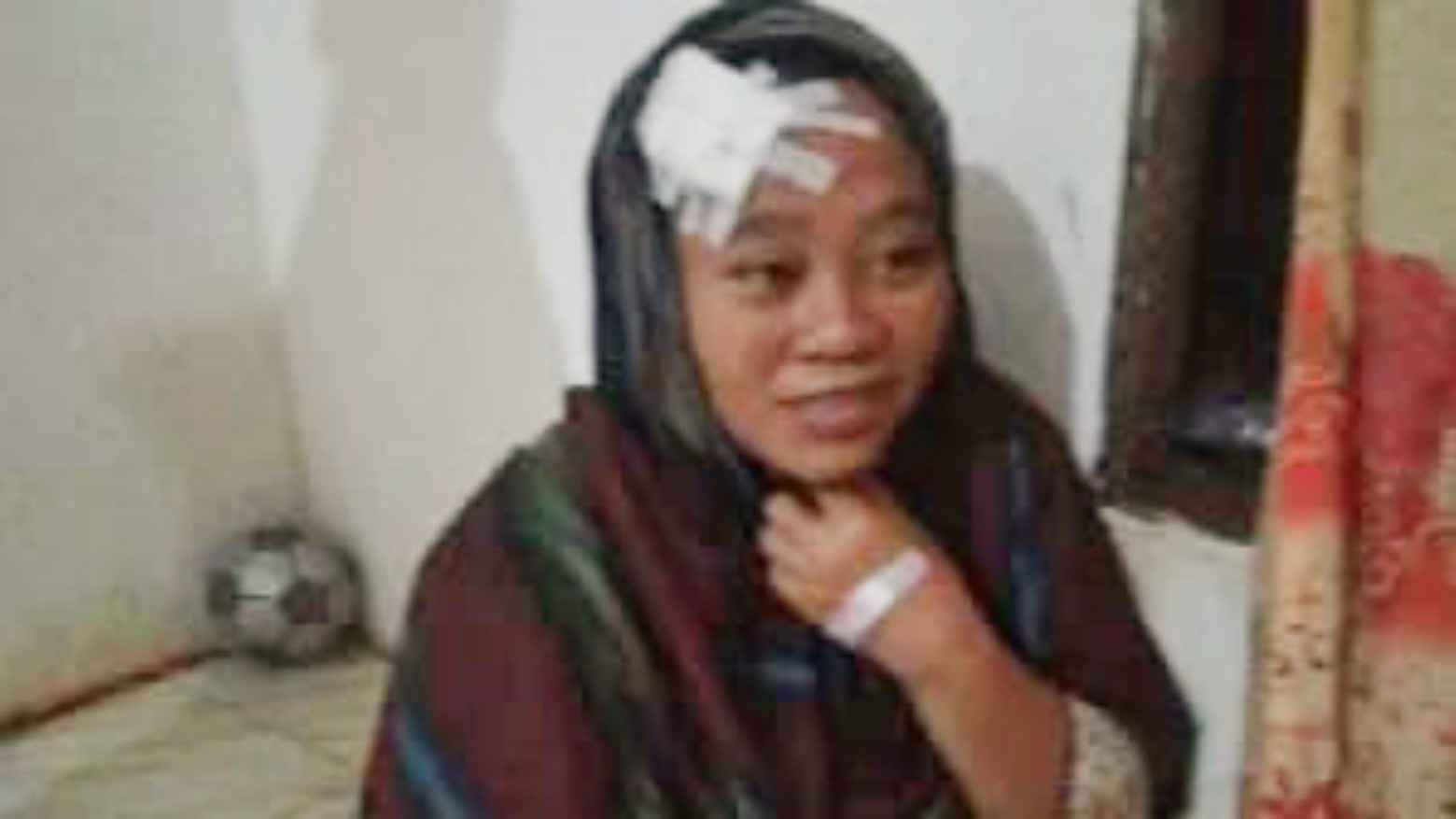 Lagi Santai di Rumah, Ibu Ini Terkena Peluru Nyasar