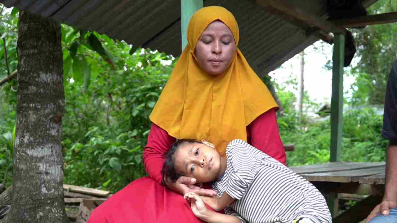 Nur Aprilia, Bocah Asal Baubau Penderita Kelainan Usus Butuh Uluran Tangan Dermawan