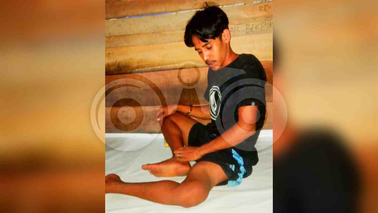 Tiga Tahun Alami Patah Tulang hingga Tidak Bisa Jalan, Pemuda Ini Butuh Biaya Operasi