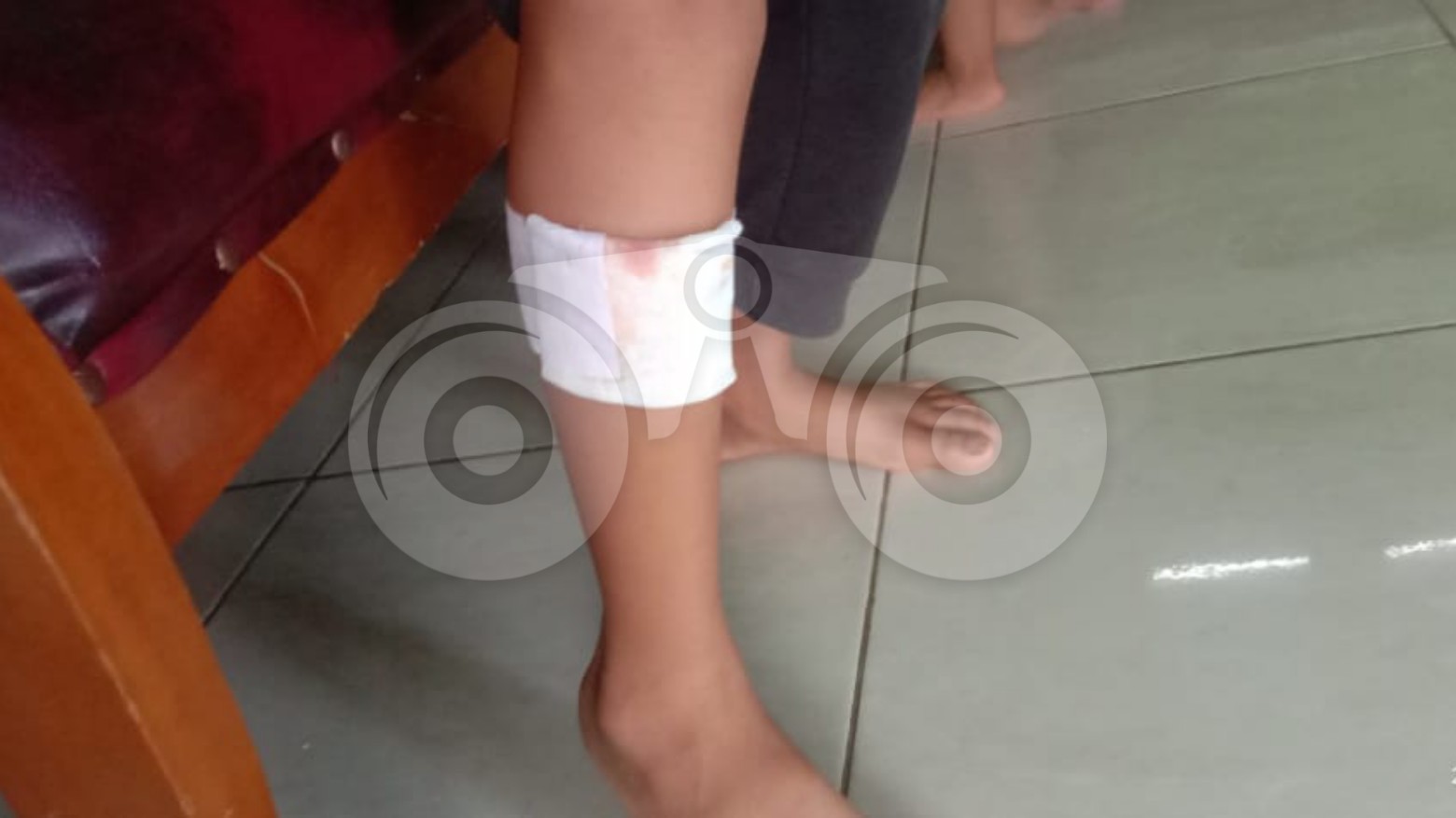 Anjing Liar Makin Ganas, Seorang Anak Jadi Korban