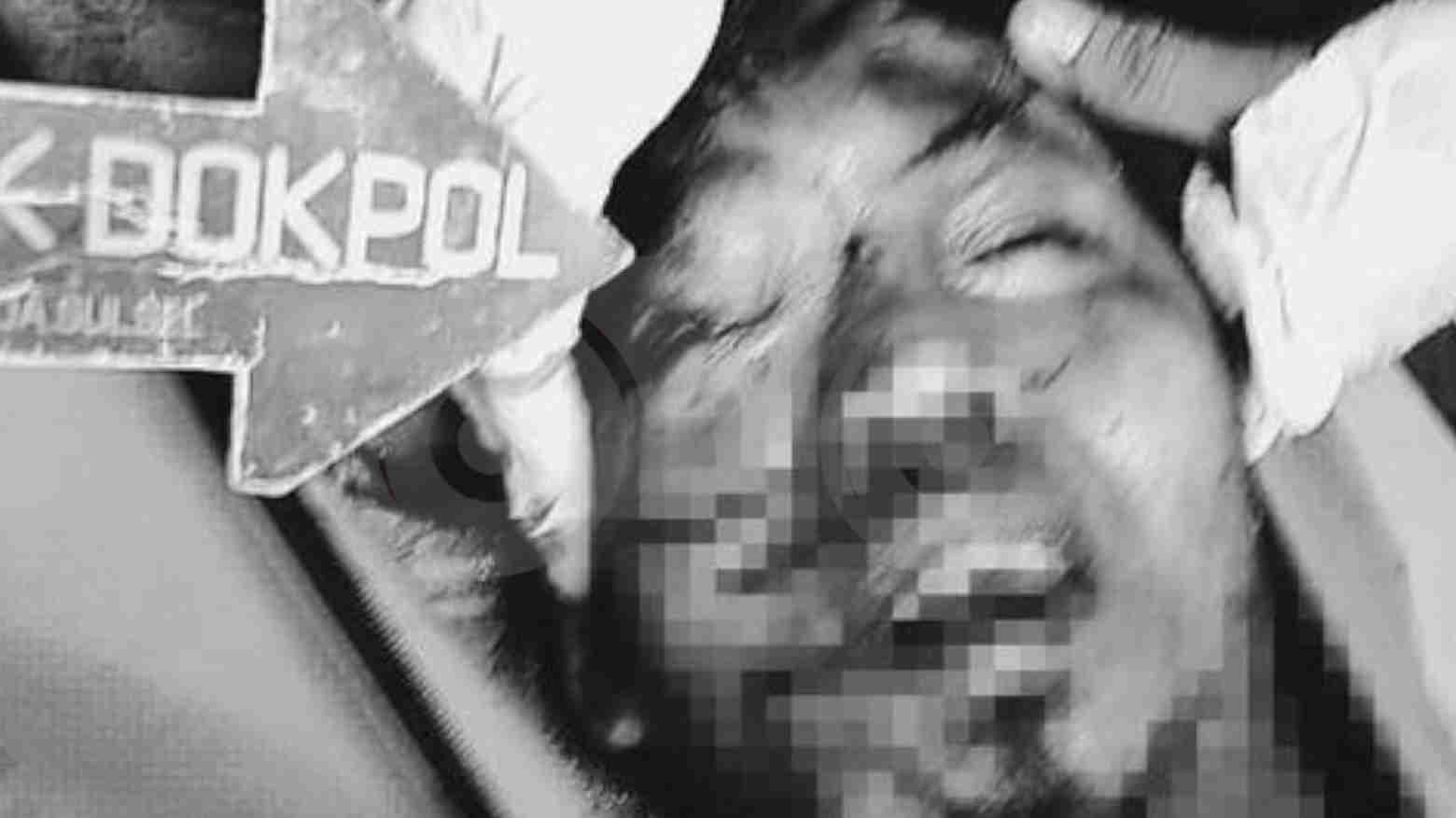 Ini Penampakan Wajah Terduga Pelaku Bom Bunuh Diri di Makassar