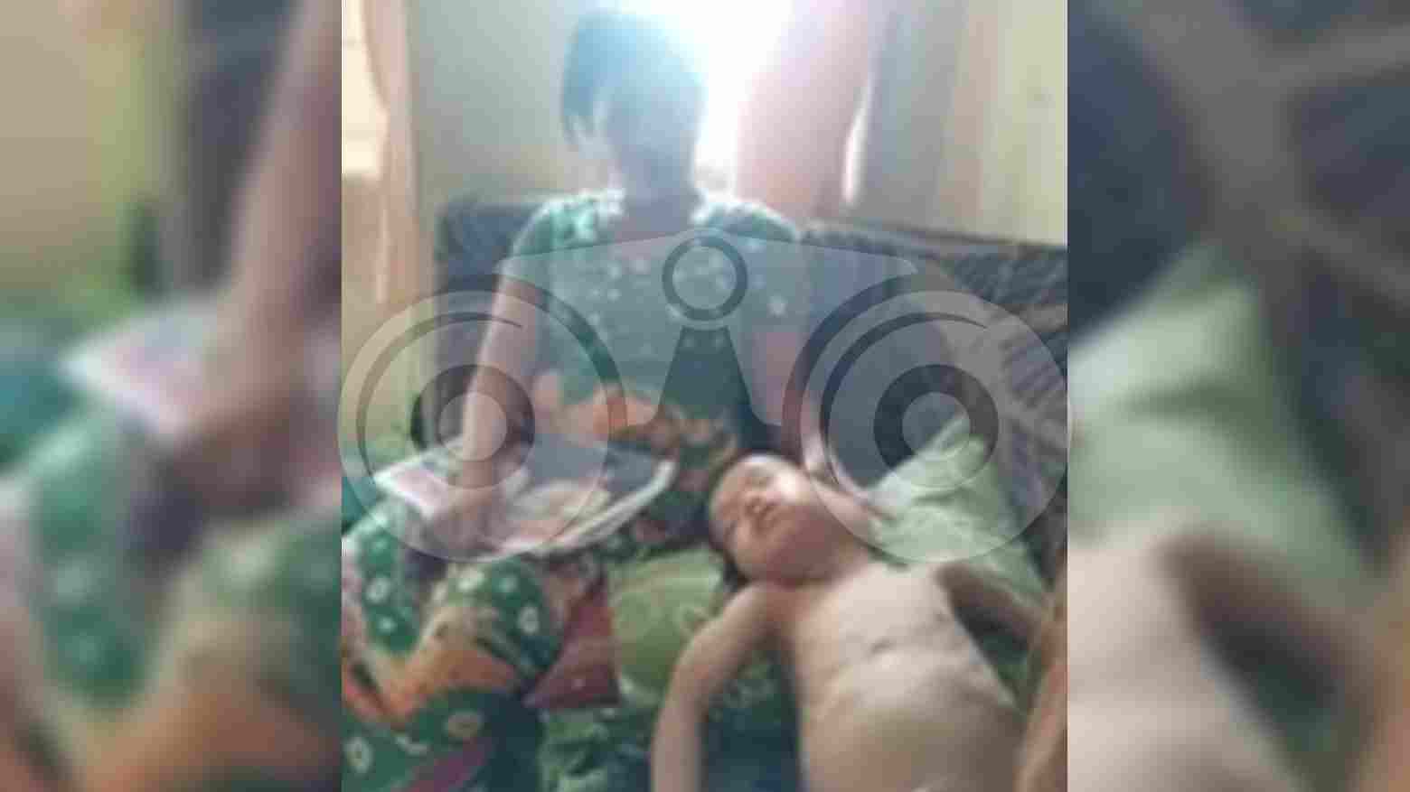 Balita Ini Sudah Dua Tahun Menderita Tumor Ganas, Butuh Bantuan Biaya Pengobatan