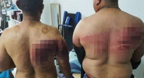 Karena Puasa, Karyawan Ini Dianiaya Majikan hingga Ditodong Pistol