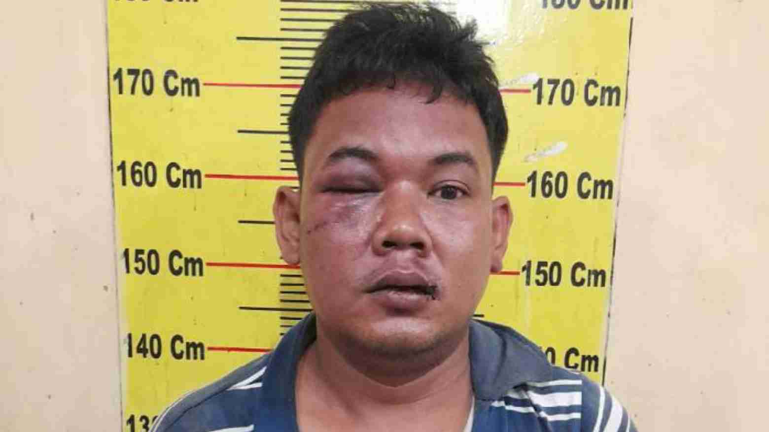 Pisah Ranjang, Istri Ditikam Suami karena Menolak Rujuk