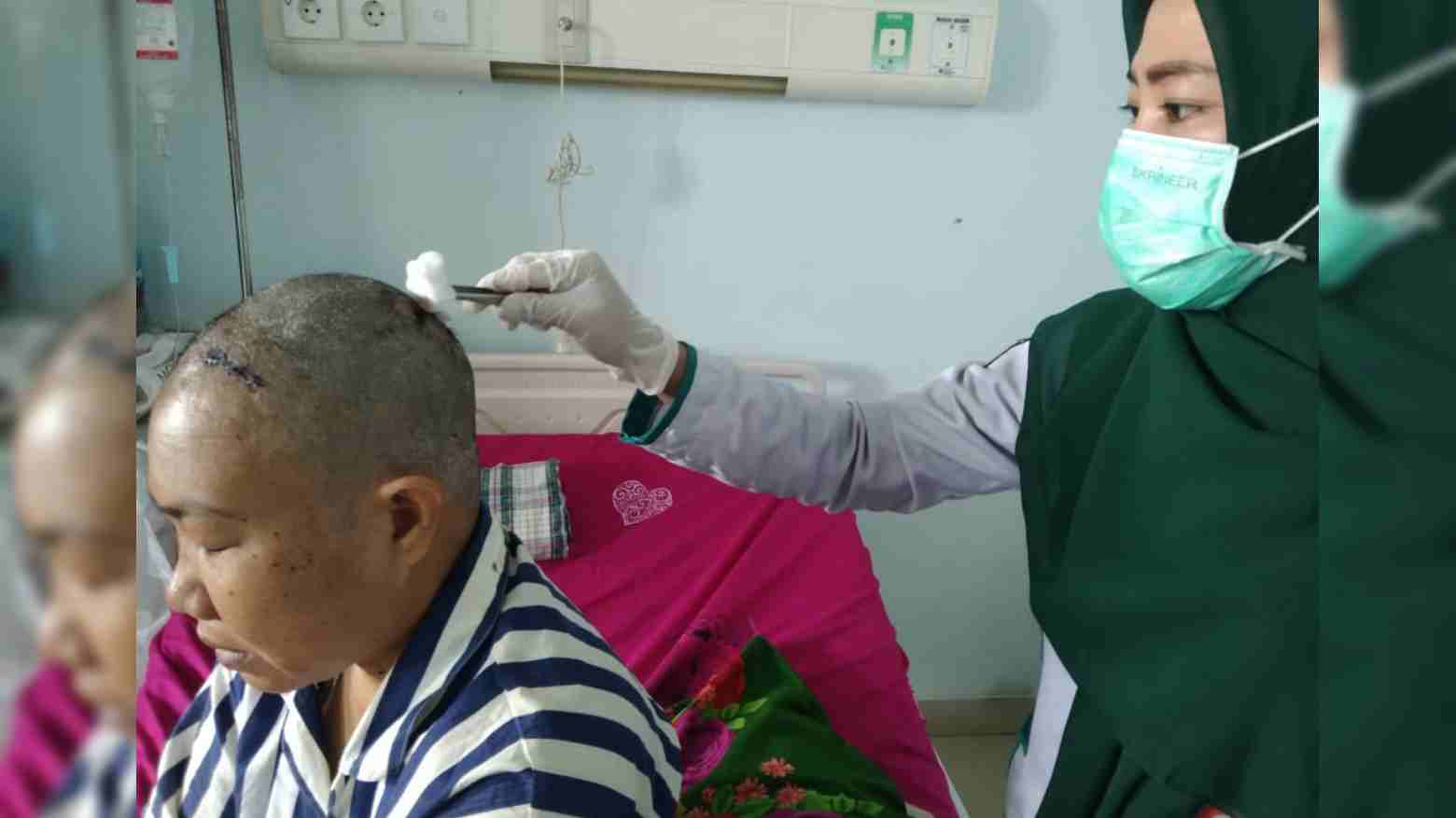 Pria di Konawe Tega Aniaya Istrinya hingga Kepala Bocor dengan 19 Jahitan