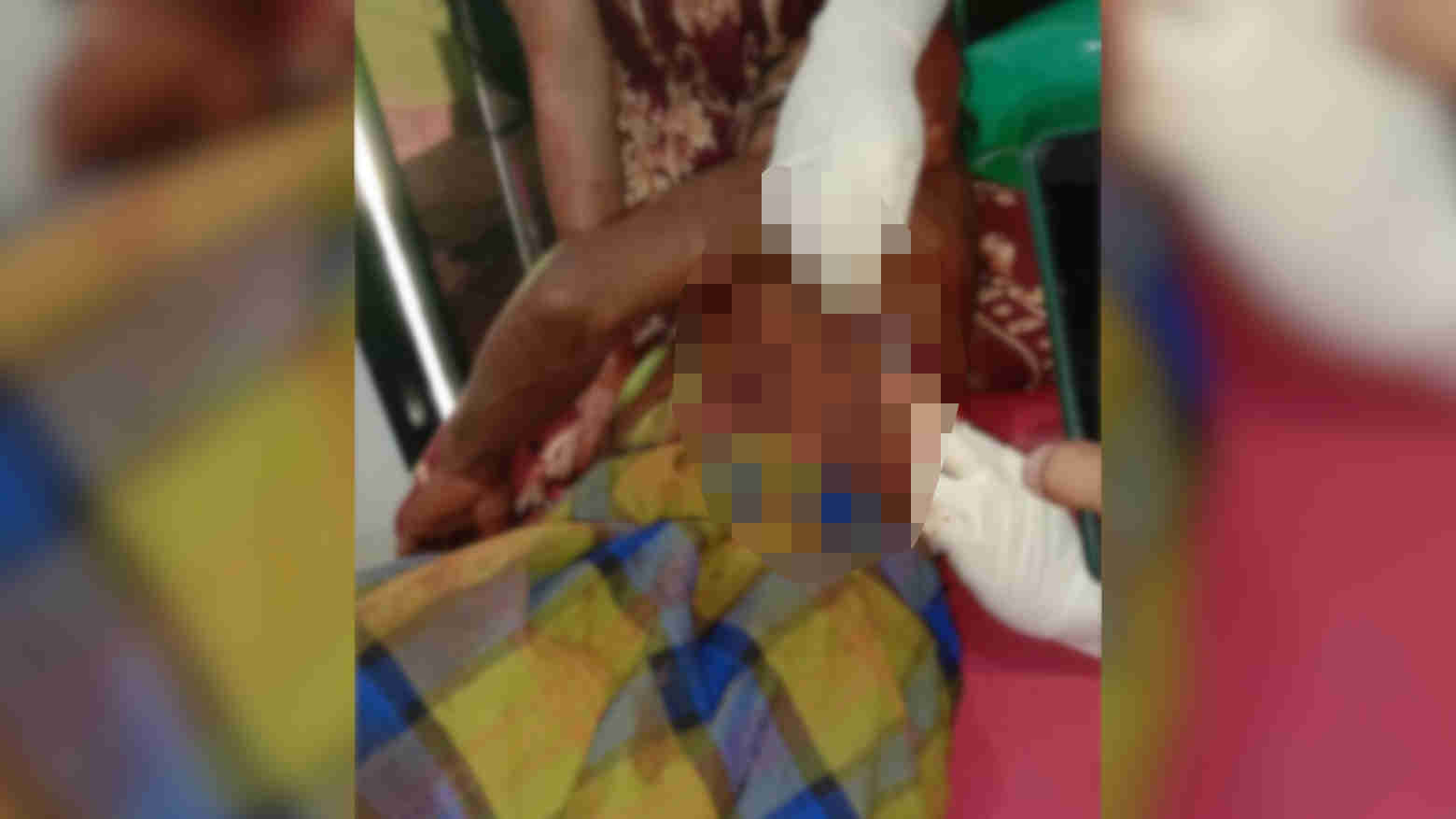 Dua Pria di Kolut Ditebas Parang Gegara Papan dan Selang Air, Ini Kronologisnya