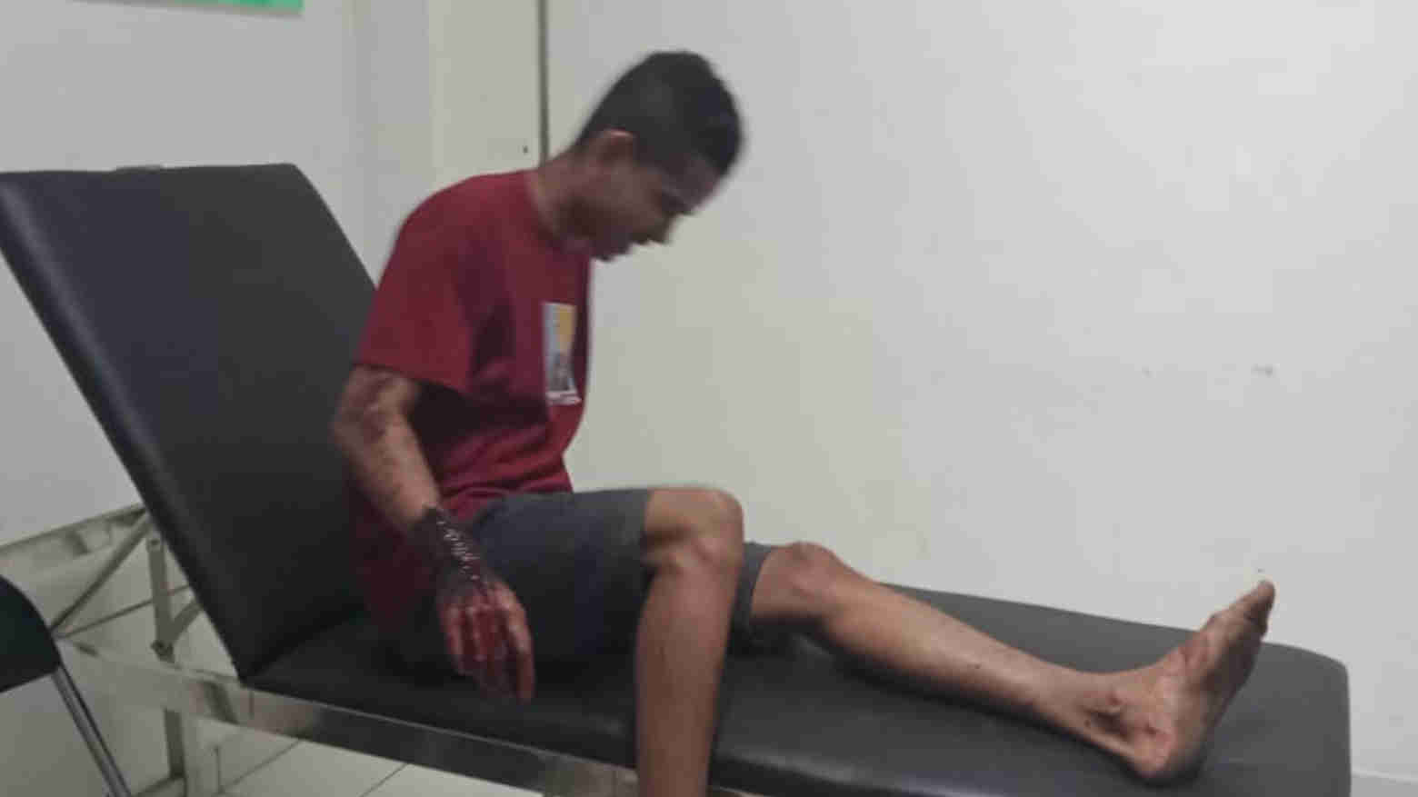 Kakaknya Hendak Diparangi, Warga Matim NTT Kena Sabetan