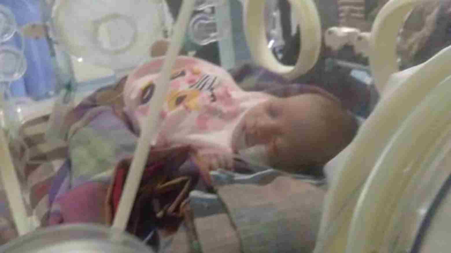 Lahir Tanpa Lubang Anus, Bayi Asal Kolut Jalani Operasi Berkat Donasi Warga