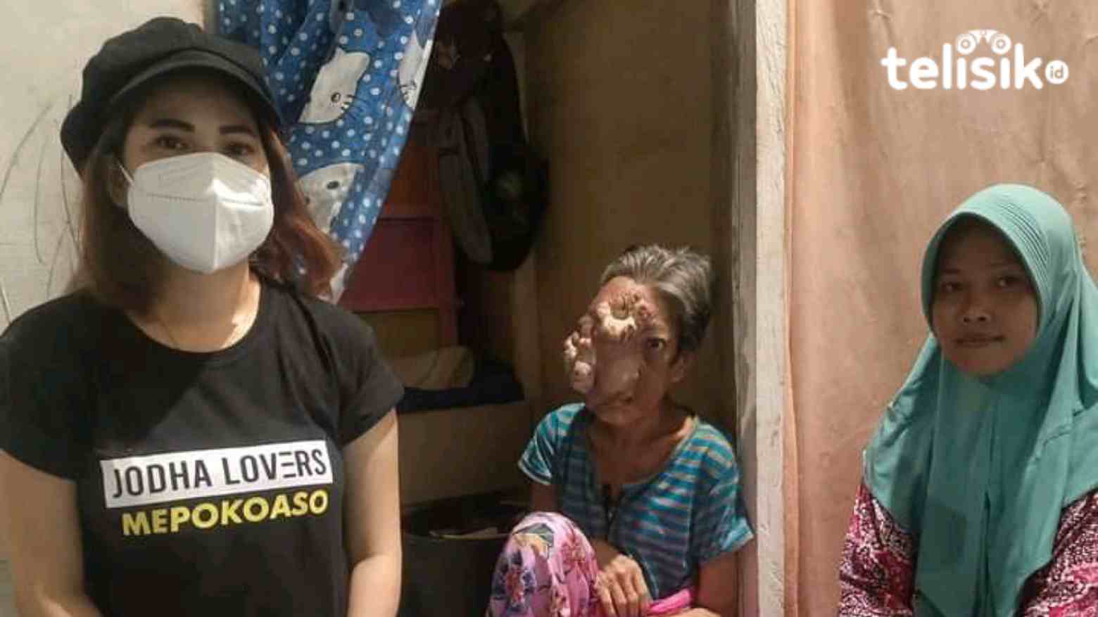 Tak Punya Biaya, Seorang Ibu di Bombana 6 Tahun Menderita Tumor di Wajah