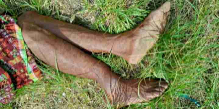 Warga Cibal Barat NTT Dipukul hingga Patah Tulang, Pelaku Ditahan Polisi