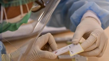 Bertambah 48 Orang, Pasien Positif COVID-19 di Kendari Capai 5.098 Kasus