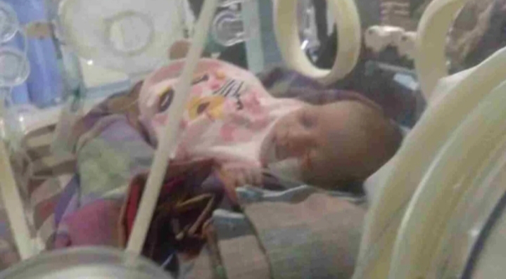 Sempat Viral, Bayi Pengidap Atresia Ani di Kolut Kini Meninggal